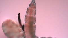 Canthocamptus staphylinus