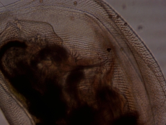 Simocephalus exspinosus