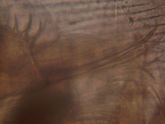 Simocephalus exspinosus