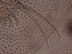 Simocephalus exspinosus