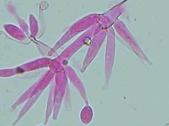 Hypomyces polyporinus