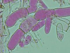 Hypomyces polyporinus