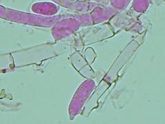 Hypomyces polyporinus