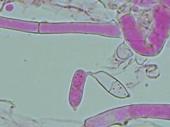 Hypomyces polyporinus