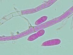 Hypomyces polyporinus
