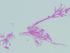 Hypomyces polyporinus