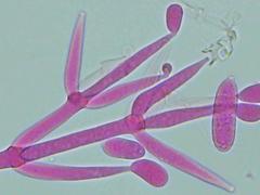 Hypomyces polyporinus