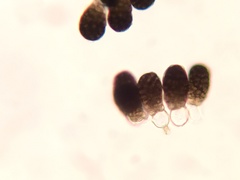 Berkleasmium inflatum
