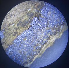 Physarum didermoides