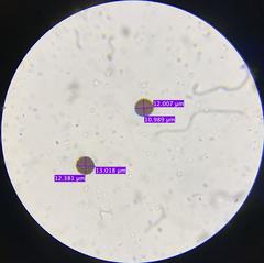 Physarum didermoides