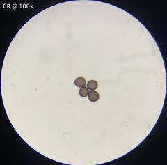 Physarum didermoides