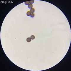 Physarum didermoides