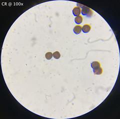 Physarum didermoides