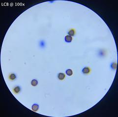 Physarum didermoides