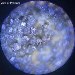 Physarum didermoides