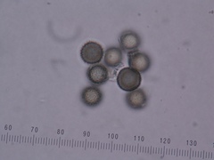 Pseudotulostoma japonicum