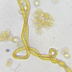 Oligonema persimile