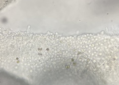 Agaricus griseicephalus