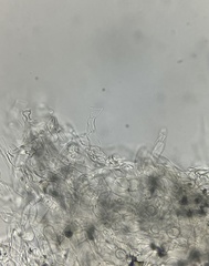 Agaricus griseicephalus