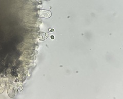 Agaricus griseicephalus