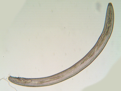 Mesocriconema