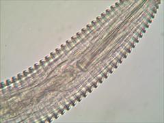 Mesocriconema