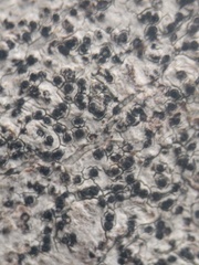 Anisomeridium biforme