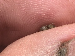 Hyalella