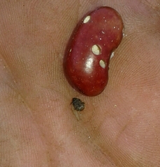 Acanthoscelides obtectus