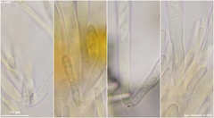 Lachnellula subtilissima