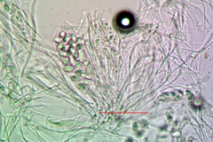 Acarospora oligospora