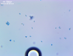 Leucoagaricus coerulescens