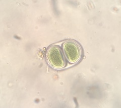 Chroococcus turgidus