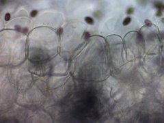 Coprinellus truncorum