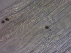 Coprinellus truncorum