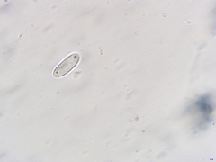 Dumontinia tuberosa