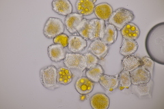 Puccinia sessilis