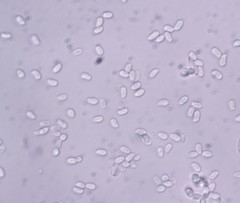 Hyphoderma