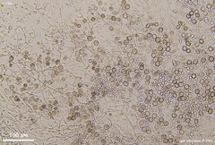 Phaeotremella mycetophiloides