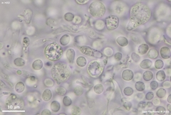 Phaeotremella mycetophiloides