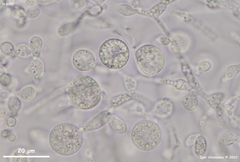 Phaeotremella mycetophiloides