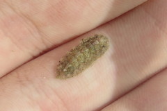 Acanthochitona pygmaea