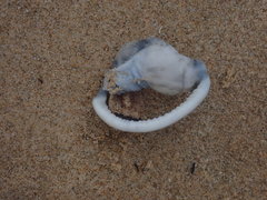 Semicassis bisulcata