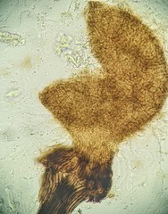 Sporothrix epigloea
