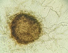 Sporothrix epigloea