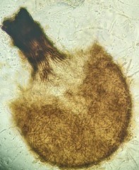 Sporothrix epigloea