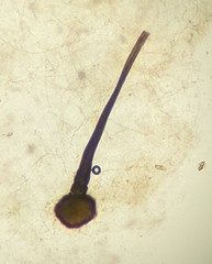 Sporothrix epigloea
