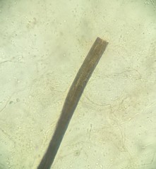 Sporothrix epigloea