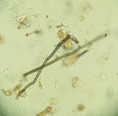 Helicosporium