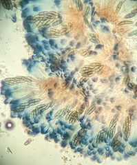 Sclerococcum stygium